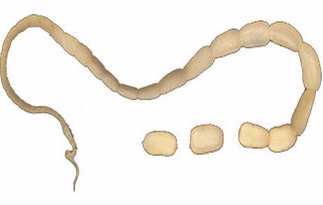 Ленточные черви у собак как выглядят Nematodes Flashcards Quizlet