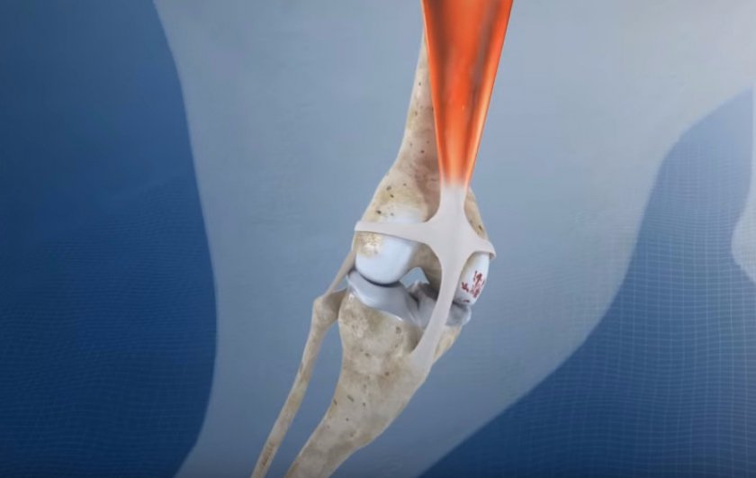 Сустав Сустав