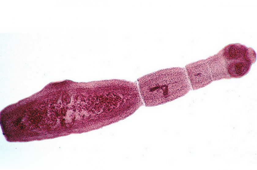 Alveococcus multilocularis