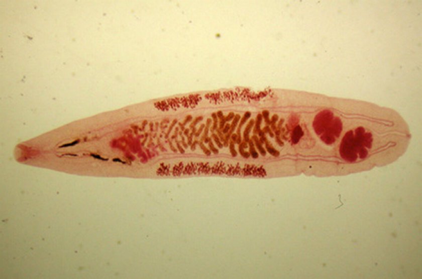 Opisthorchis felineus