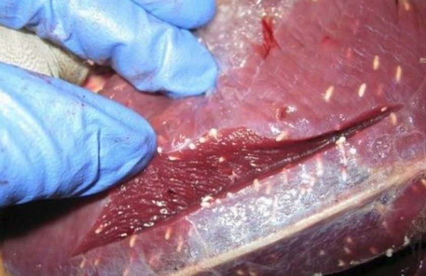 Трихинеллез