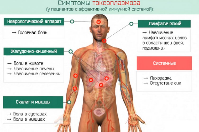 Токсоплазмоз