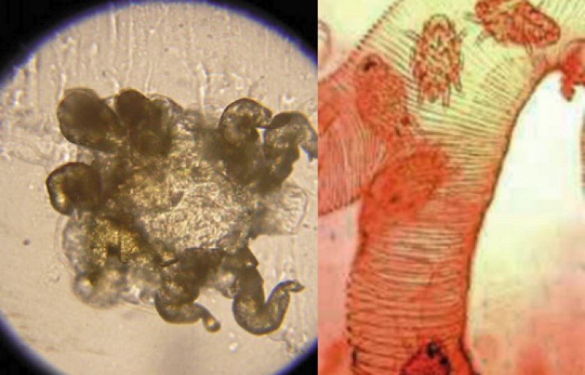 Трахейный клещ Трахейный клещ