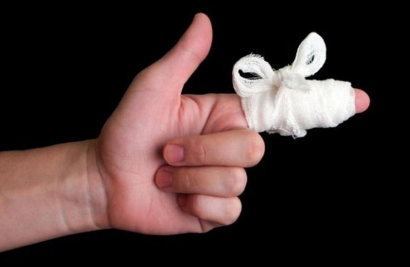 Что делать с раной от укуса хомяка