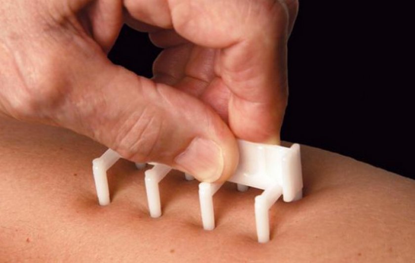 Кожная проба