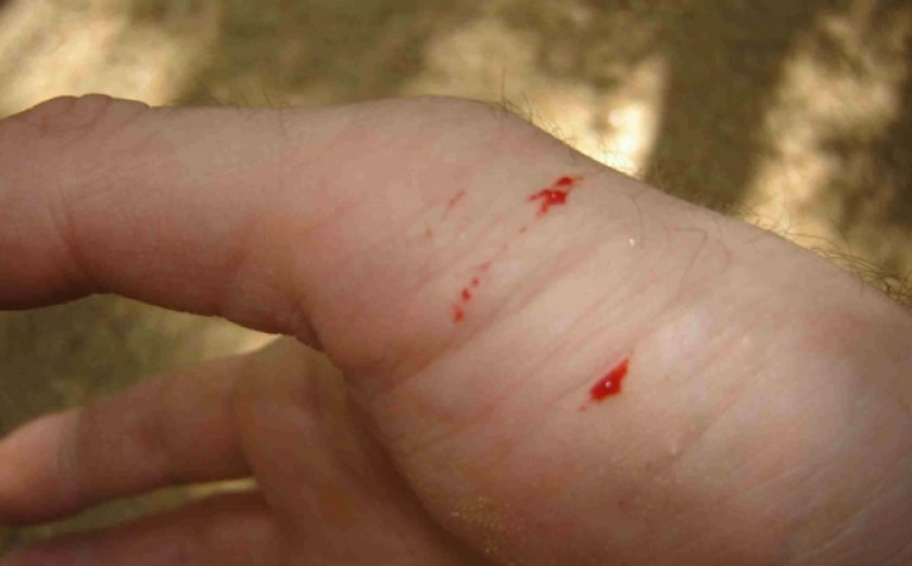 Укус змеи Укус змеи