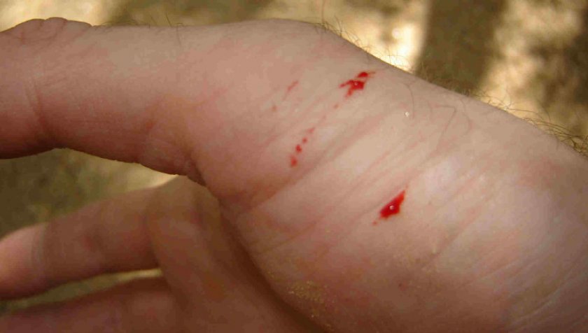 Укус змеи Укус змеи