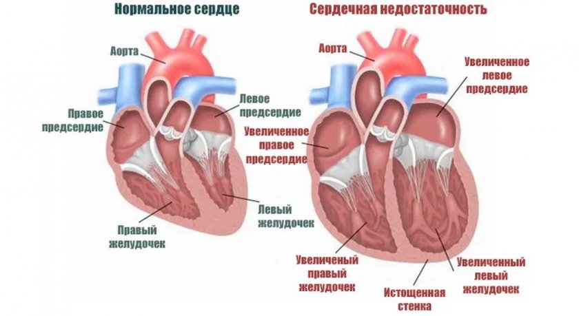 Сердечная недостаточность у собак Сердечная недостаточность у собак