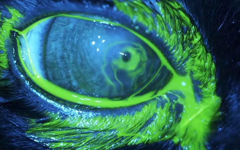 Проба Зейделя Проба Зейделя