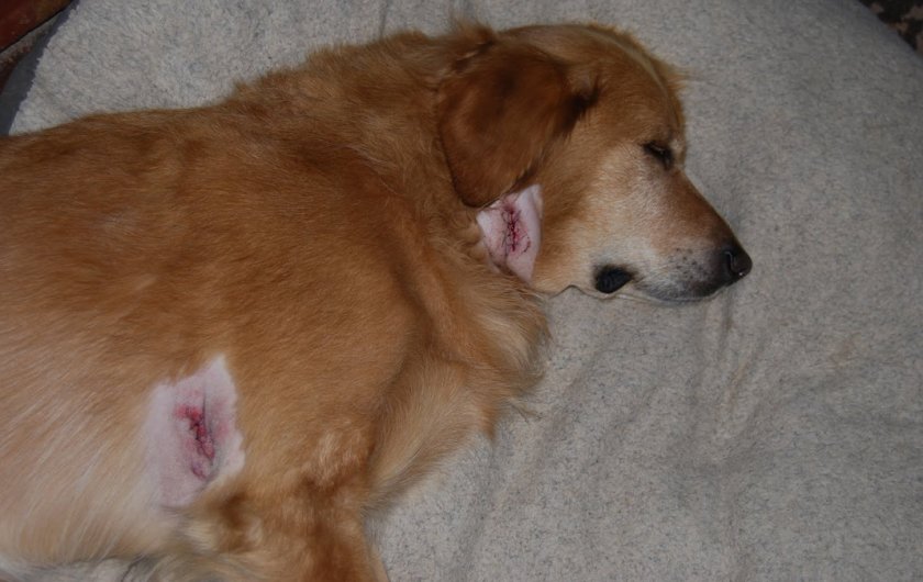 Оперативное удаление липомы