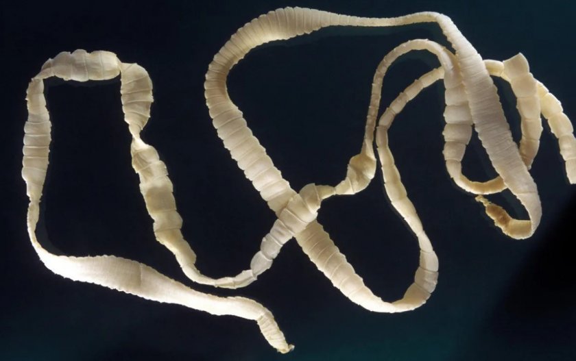 Ленточный червь