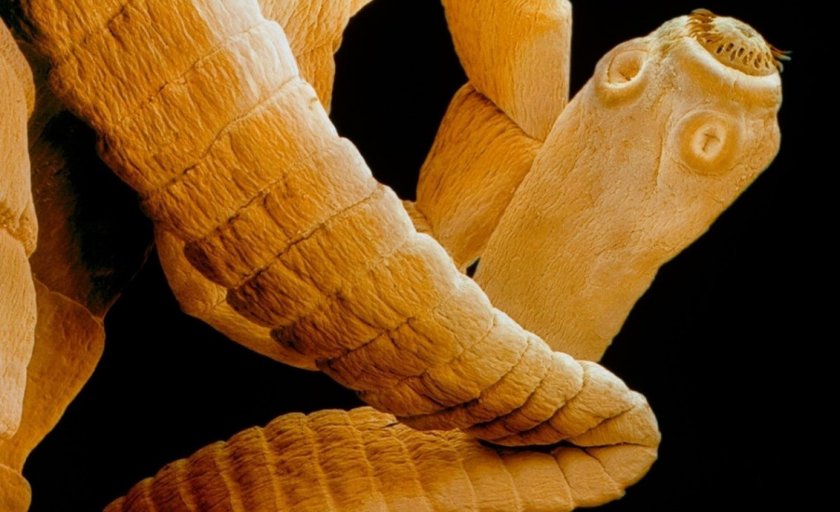 Свиной цепень