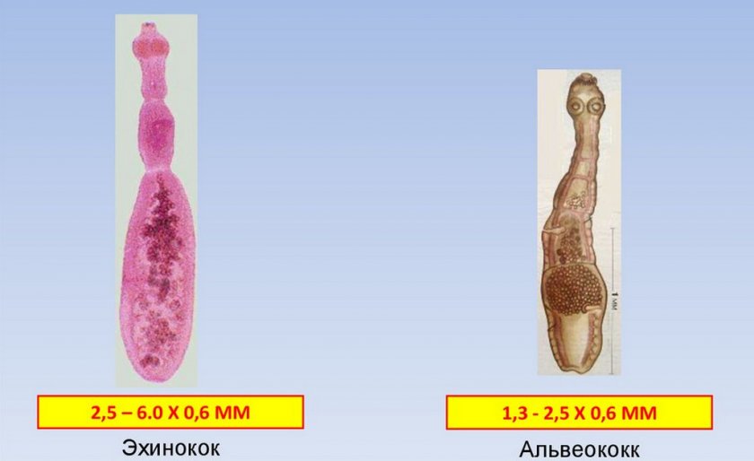 Эхинококк и альвеококк