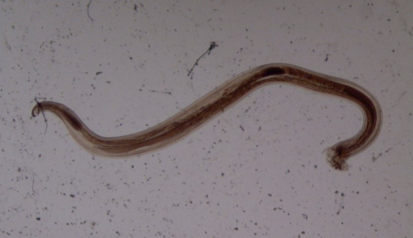 Анкилостома