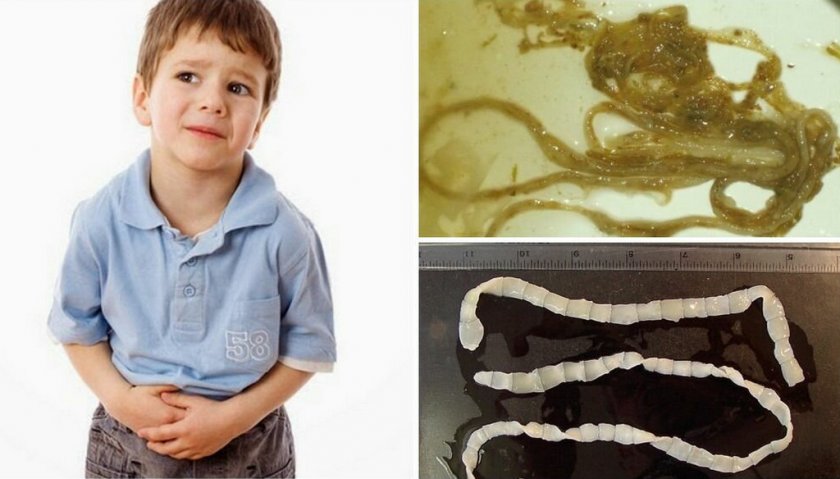 Опасность глистов для ребёнка