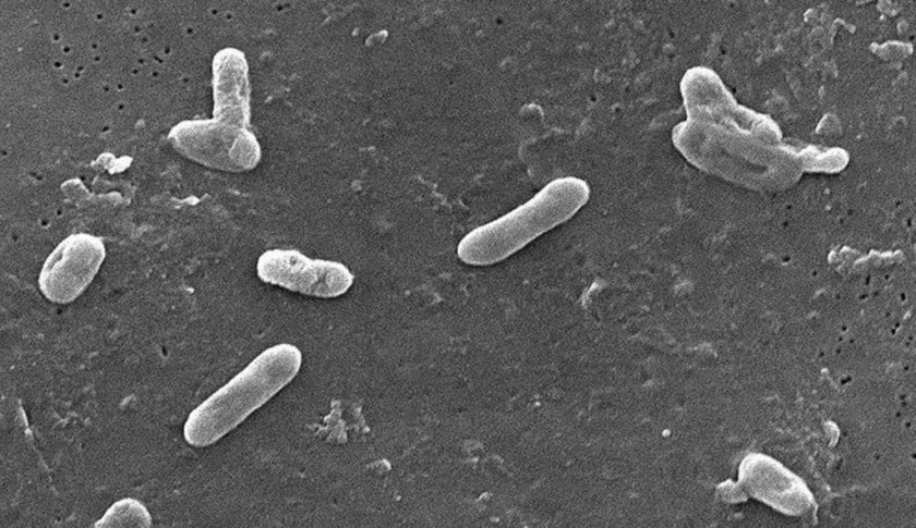 Bordetella bronchiseptica Bordetella bronchiseptica