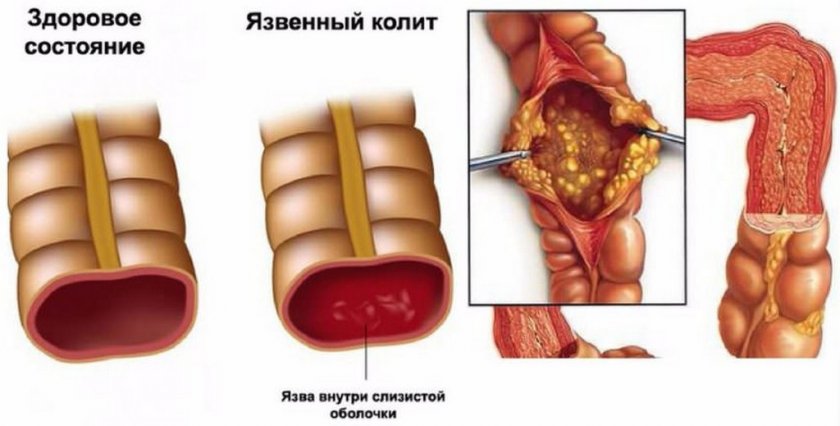 Язвенный колит у собаки