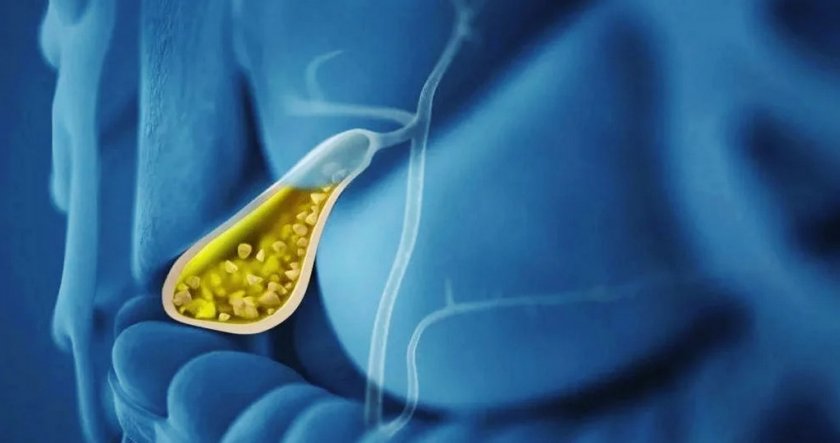 Застой желчи