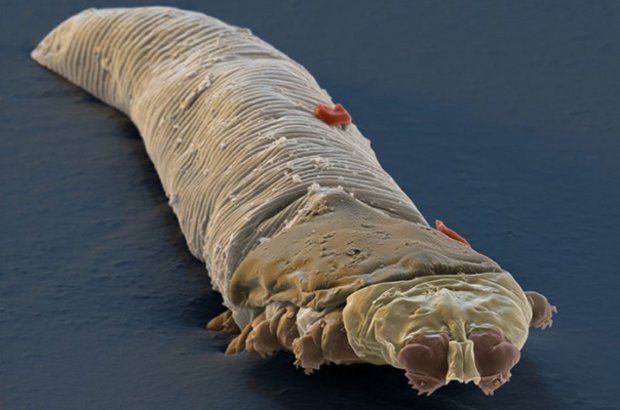 Demodex canis Demodex canis