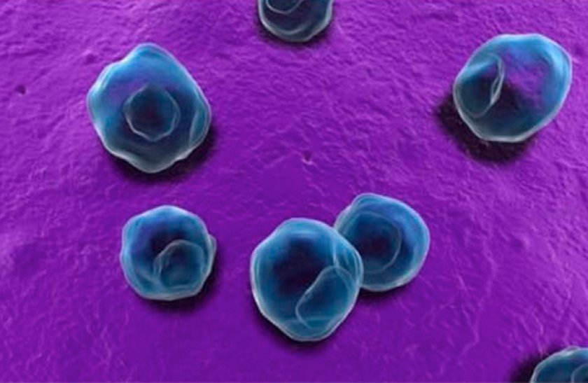 Хламидиоз Хламидиоз