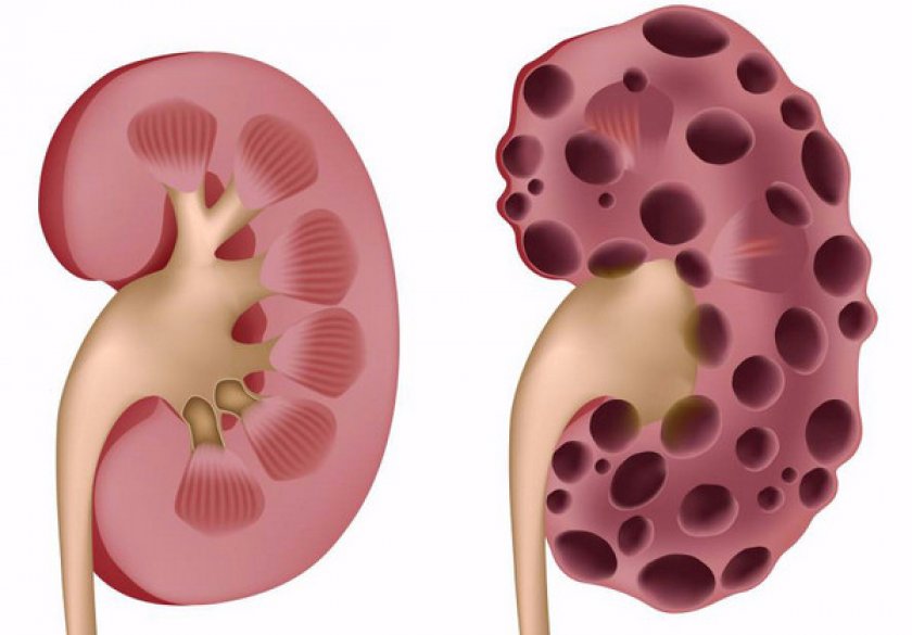 Почечная недостаточность у кошек